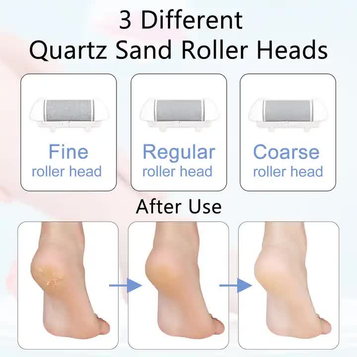NNEDSZ Blue Rechargeable Electric Foot File Callus Remover with LED Display and USB Charging-3
